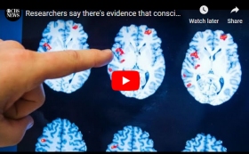 Researchers say there's evidence that consciousness continues after clinical death Researchers say there's evidence that consciousness continues after clinical death